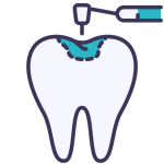 Dental Fillings